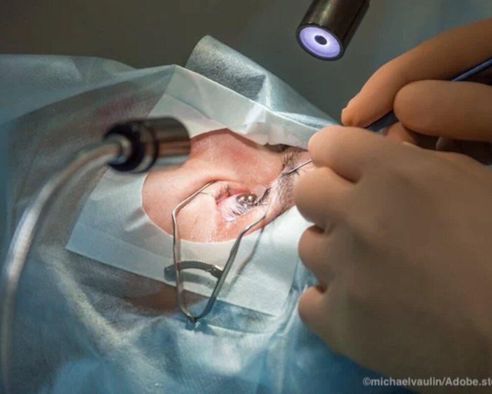 Cataract & IOL Surgery